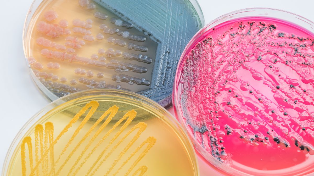 Unternehmenskulturen zusammenbringen: 3 Petrischalen mit Kulturen in verschiedenen Farben - hellblau, rosa, gelb